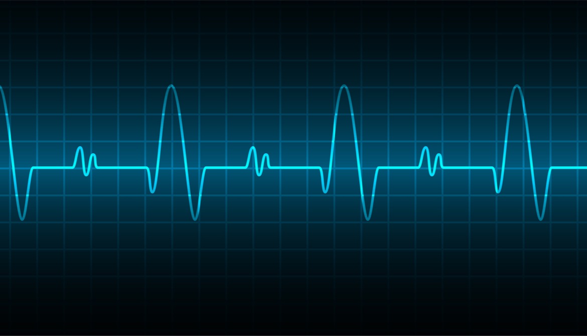 digital image of heart rate or EKG wave